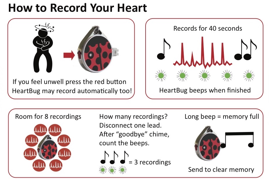 How to Use HeartBug